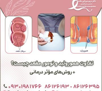 تفاوت هموروئید و تومور مقعد چیست؟ + روش‌های مؤثر درمانی