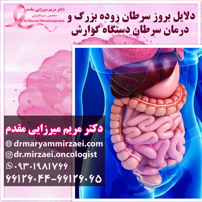 درمان سرطان دستگاه گوارش