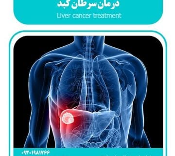 درمان سرطان کبد