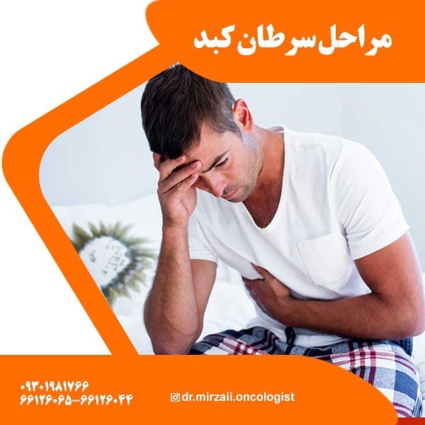 مراحل سرطان کبد و درمان سرطان کبد