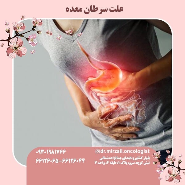 متخصص درمان سرطان معده