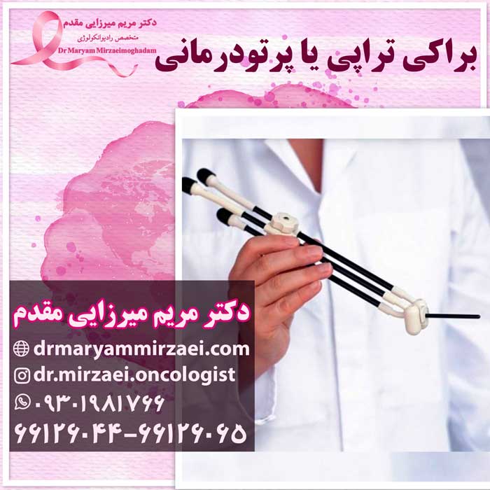 براکی تراپی پرتودرمانی سرطان