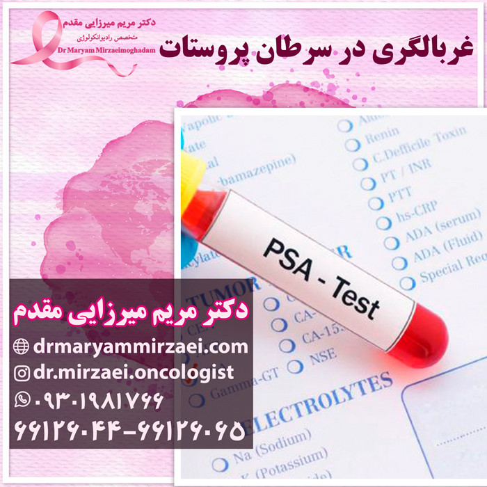 درمان سرطان پروستات