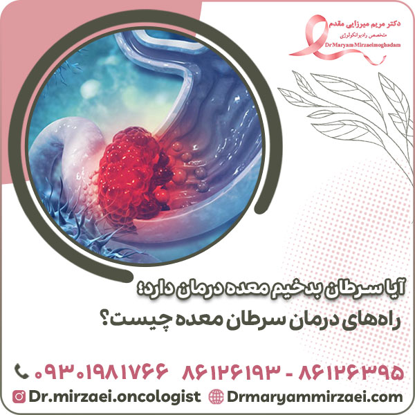 آیا سرطان بدخیم معده درمان دارد؛ راه های درمان سرطان معده چیست؟