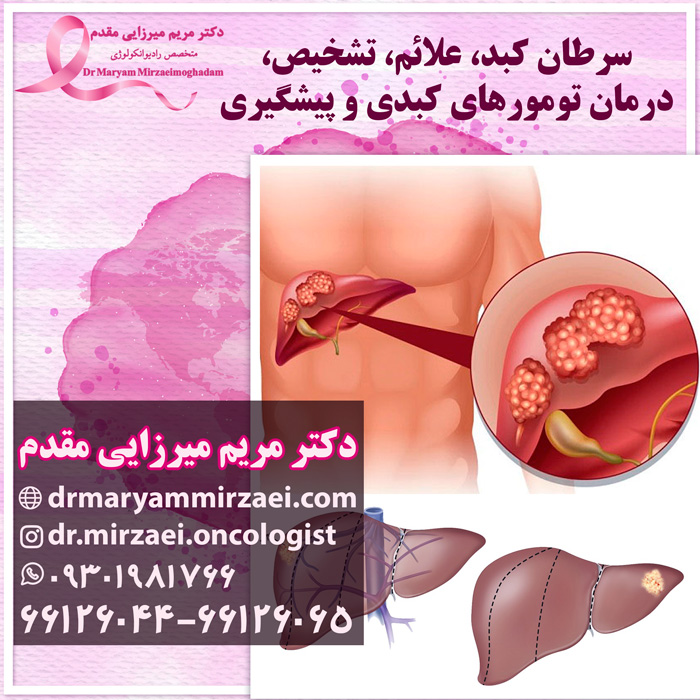 درمان سرطان کبد و پیشگیری