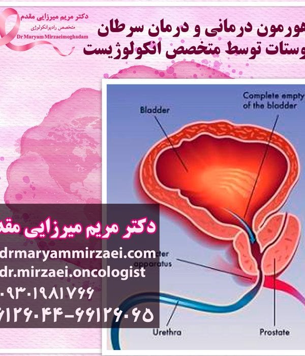 هورمون درمانی سرطان پروستات