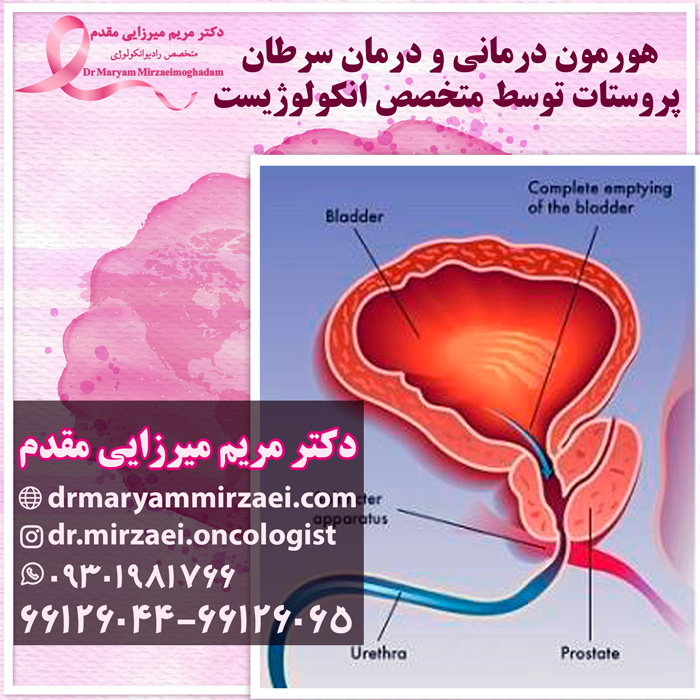 هورمون درمانی سرطان پروستات