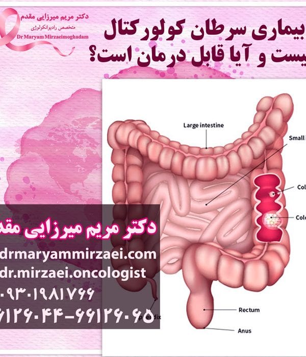 درمان سرطان کولورکتال