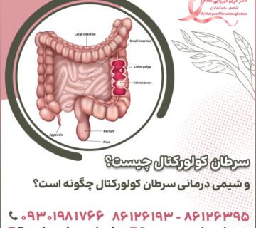 سرطان کولورکتال چیست؟ و شیمی درمانی سرطان کولورکتال چگونه است؟