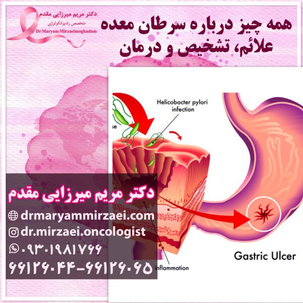 همه چیز درباره سرطان معده علائم، تشخیص و درمان دکتر میرزایی مقدم