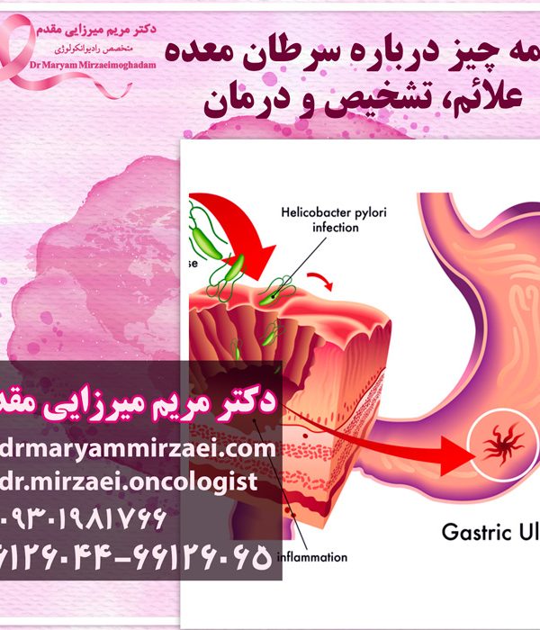درمان سرطان معده