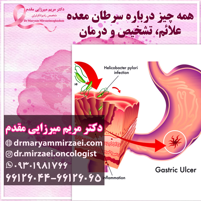 درمان سرطان معده
