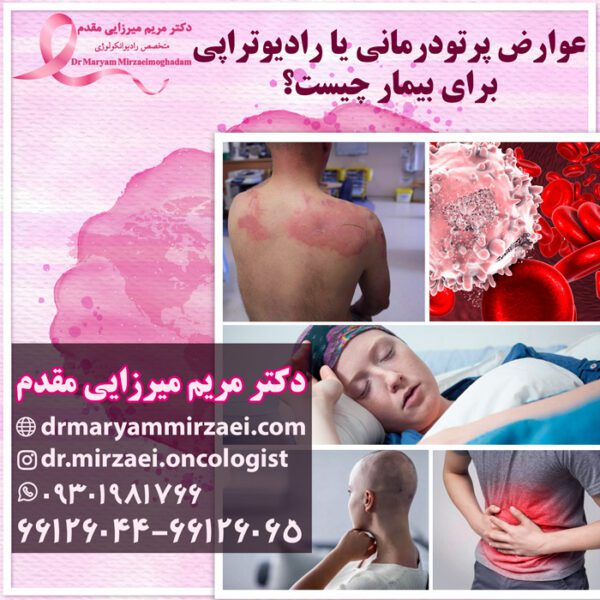 عوارض پرتودرمانی یا رادیوتراپی