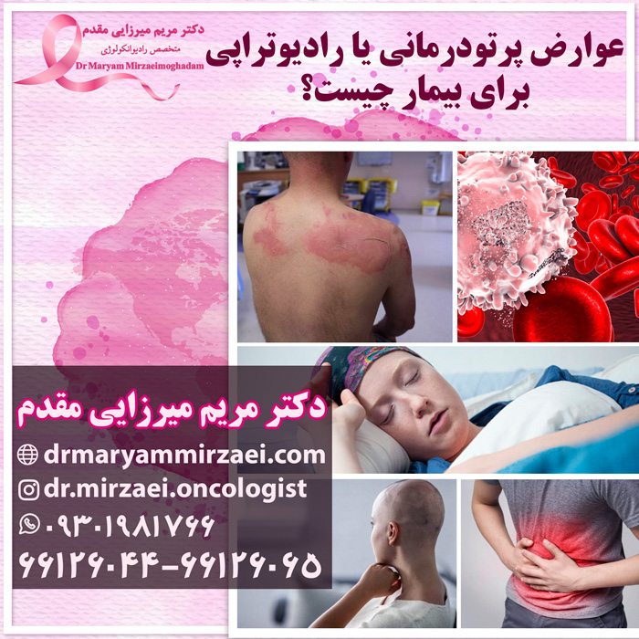 عوارض پرتودرمانی یا رادیوتراپی