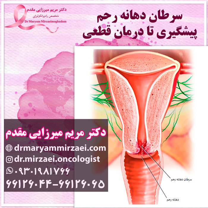 درمان سرطان دهانه رحم