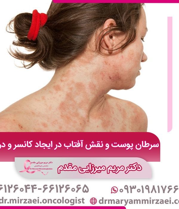 درمان سرطان پوست