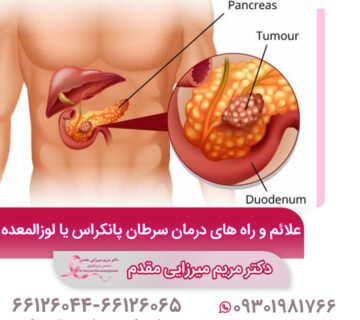 علائم و راه های درمان سرطان پانکراس یا لوزالمعده