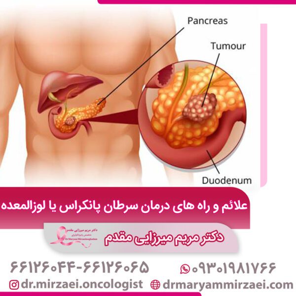 علائم و راه های درمان سرطان پانکراس یا لوزالمعده
