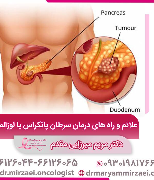 علائم و راه های درمان سرطان پانکراس یا لوزالمعده