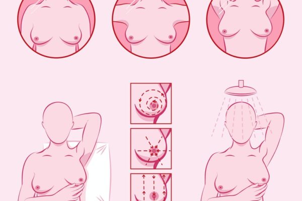 معاینه سرطان سینه در منزل معاینه سرطان سینه در منزل