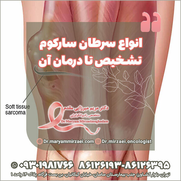 انواع سرطان سارکوم تشخیص تا درمان آن