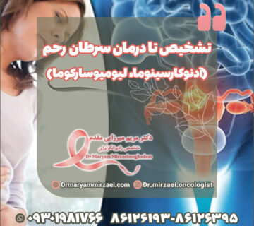 تشخیص و درمان سرطان رحم