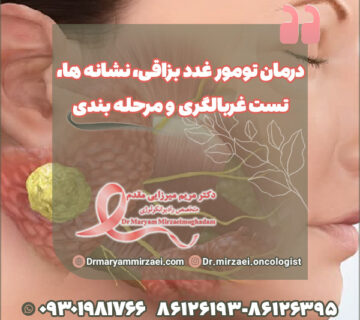 درمان تومور غدد بزاقی