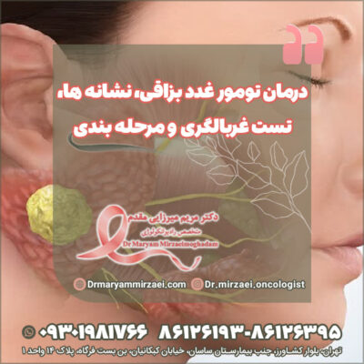 درمان تومور غدد بزاقی درمان تومور غدد بزاقی