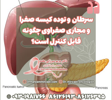 سرطان و توده کیسه صفرا و مجاری صفراوی