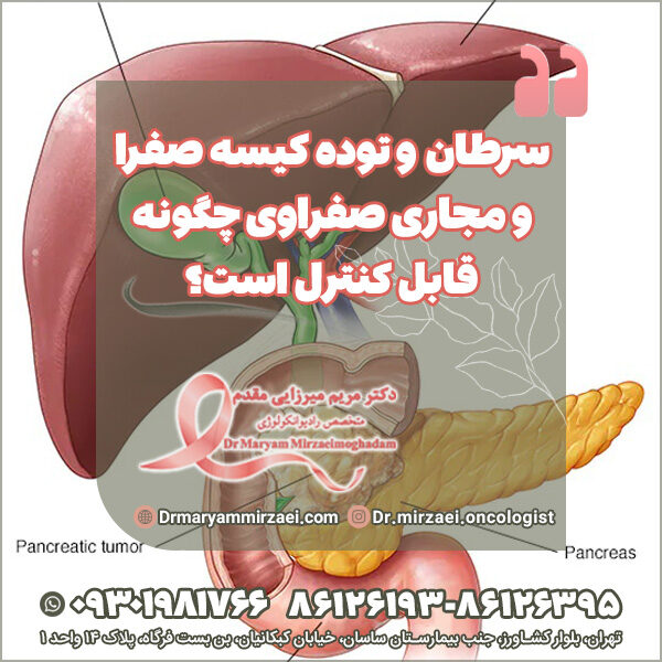 سرطان و توده کیسه صفرا و مجاری صفراوی