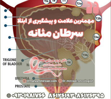 مهمترین علامت سرطان مثانه و پیشگیری از ابتلا
