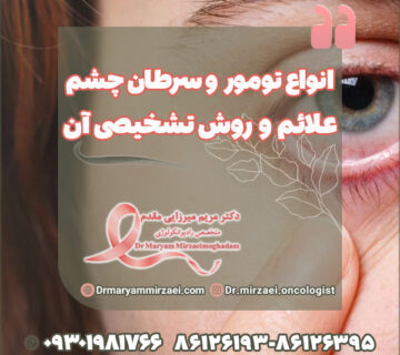 انواع تومور و سرطان چشم علائم و روش تشخیصی آن