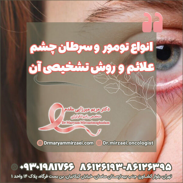 انواع تومور و سرطان چشم علائم و روش تشخیصی آن