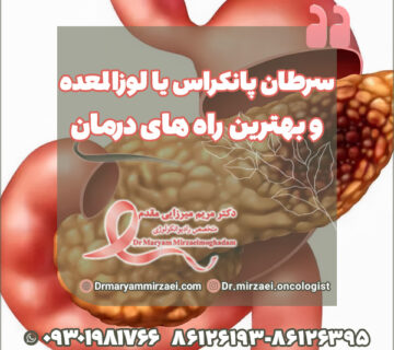 سرطان پانکراس یا لوزالمعده و بهترین راه های درمان