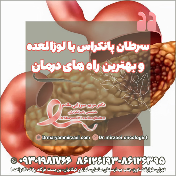 سرطان پانکراس یا لوزالمعده و بهترین راه های درمان