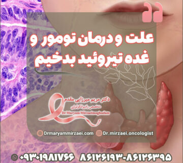 علت و درمان تومور و غده تیروئید بدخیم