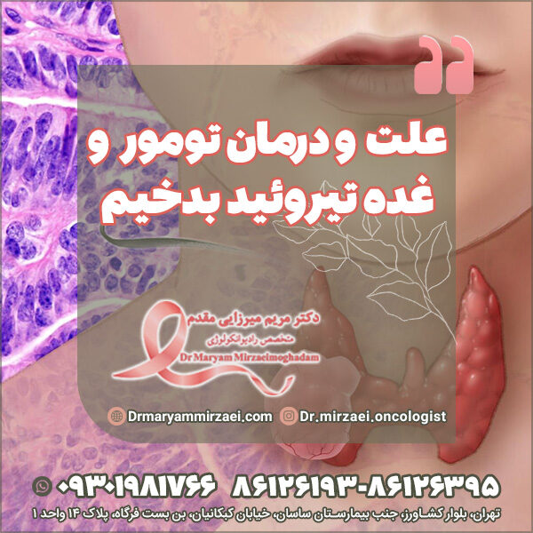علت و درمان تومور و غده تیروئید بدخیم