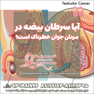 آیا سرطان بیضه در مردان جوان خطرناک است؟ آیا سرطان بیضه در مردان جوان خطرناک است؟