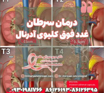 درمان سرطان غدد فوق کلیوی آدرنال توسط متخصص