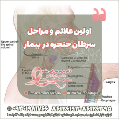 اولین علائم و مراحل سرطان حنجره در بیمار اولین علائم و مراحل سرطان حنجره در بیمار