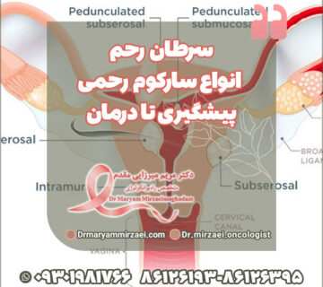 سرطان رحم و انواع سارکوم رحمی، پیشگیری تا درمان