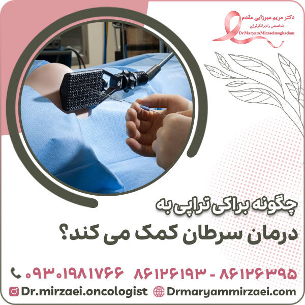 چگونه براکی تراپی به درمان سرطان کمک می کند؟