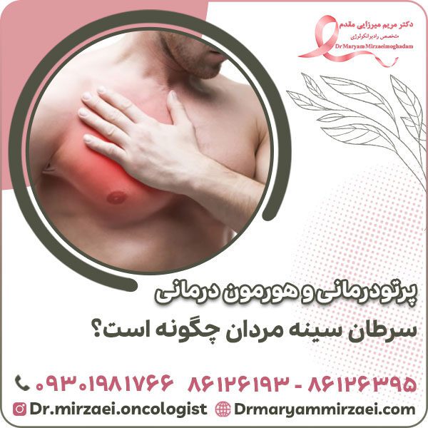 پرتودرمانی و هورمون درمانی سرطان سینه مردان چگونه است؟