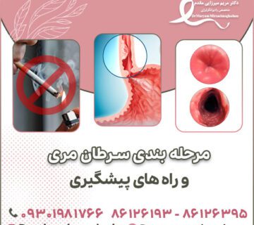 مرحله بندی سرطان مری و راه های پیشگیری