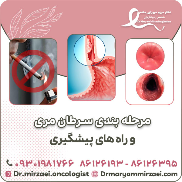 مرحله بندی سرطان مری و راه های پیشگیری