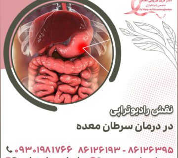 نقش رادیوتراپی در درمان سرطان معده