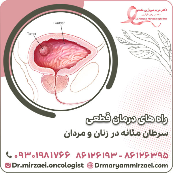 راه های درمان قطعی سرطان مثانه در زنان و مردان