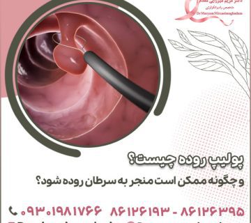 پولیپ چیست و چگونه ممکن است منجر به سرطان روده شود؟