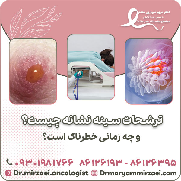 ترشحات سینه نشانه چیست و چه زمانی خطرناک است؟
