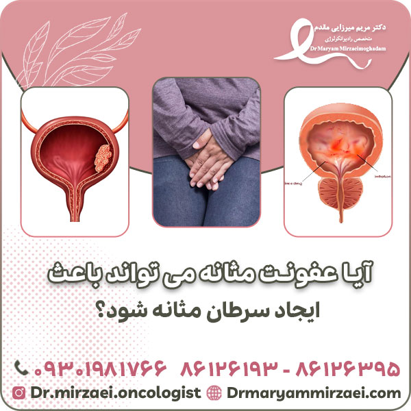 آیا عفونت مثانه می تواند باعث ایجاد سرطان مثانه شود؟